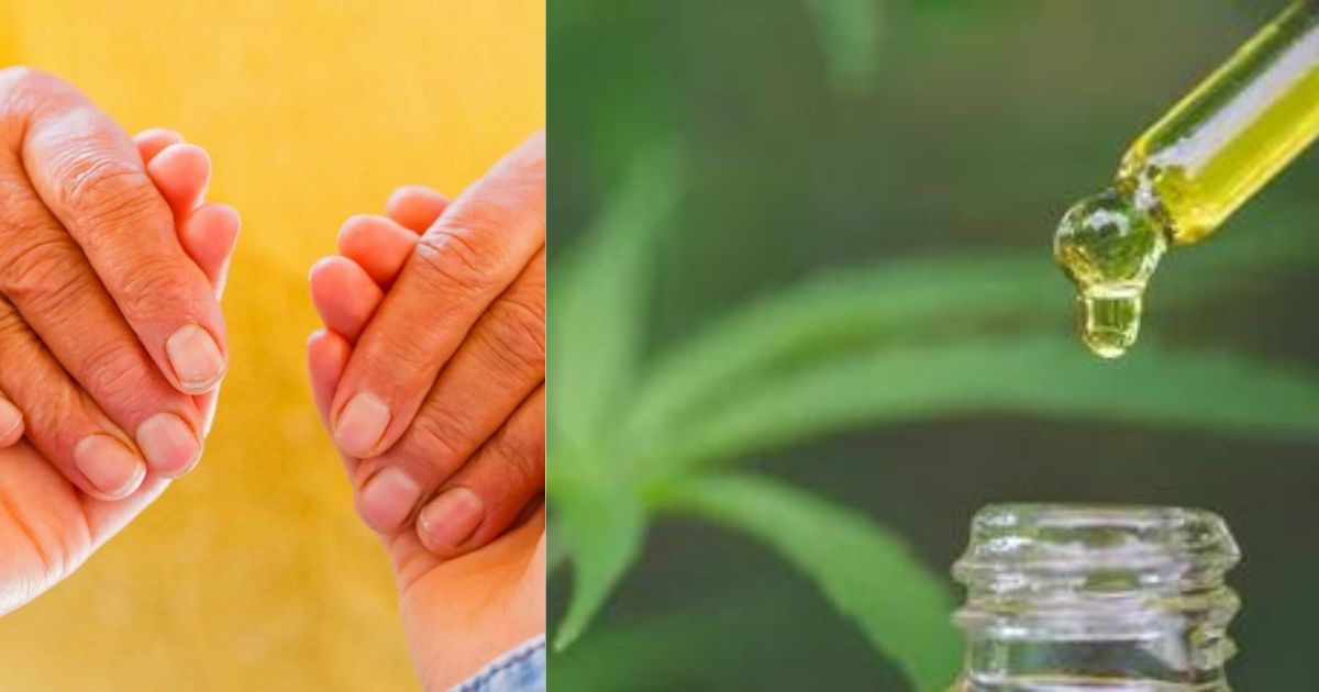 CBD and Parkinson’s Disease