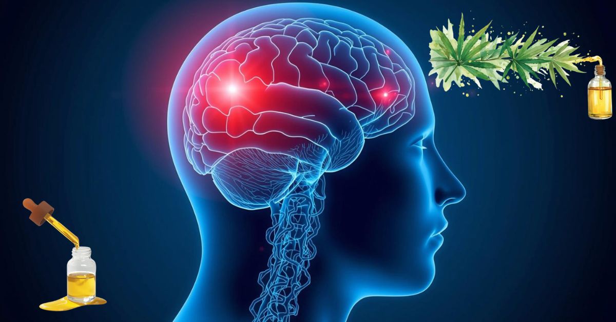 CBD Good for Vestibular Migraine