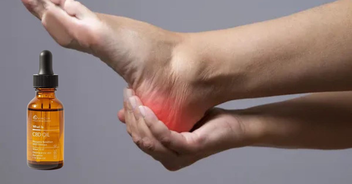 CBD Oil For Plantar Fasciitis